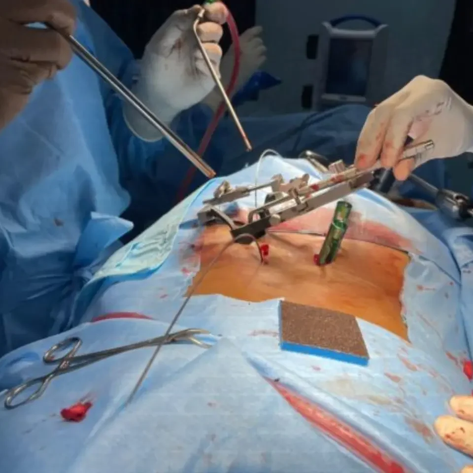 Spine Surgery Application